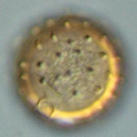  urediniospore of  P. paullula 
